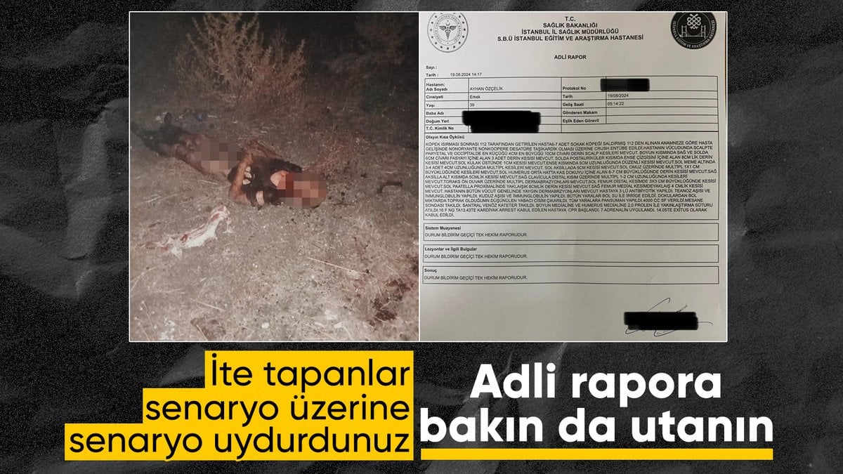 Fatih’te başıboş köpeklerin saldırısında ölen kişinin hastane raporu yayınlandı